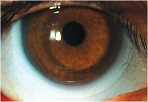 Eyecare Associates of Lee's Summit
